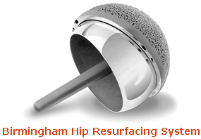 Birmingham Hip Resurfacing System