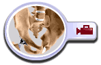 Anterior Hip Replacement